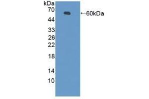 Detection of Recombinant PZP, Mouse using Polyclonal Antibody to Pregnancy Zone Protein (PZP) (PZP antibody  (AA 1224-1495))