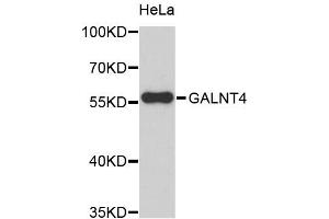 Western blot analysis of extracts of HeLa cells, using GALNT4 antibody (ABIN5972364).