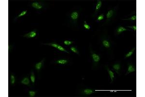 Immunofluorescence of monoclonal antibody to D4S234E on HeLa cell.