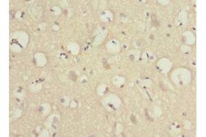 PRUNE2 antibody  (AA 1-250)