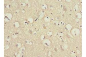 Immunohistochemistry of paraffin-embedded human brain tissue using ABIN7165996 at dilution of 1:100 (PRUNE2 antibody  (AA 1-250))