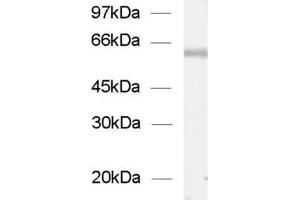 dilution: 1 : 1000, sample: enriched vesicles from rat spinal chord (ChT antibody  (AA 501-580))