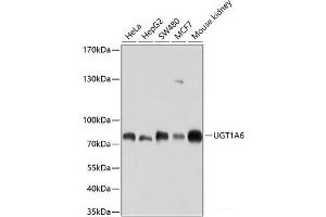 Western blot analysis of extracts of various cell lines using UGT1A6 Polyclonal Antibody at dilution of 1:1000. (UGT1A6 antibody)