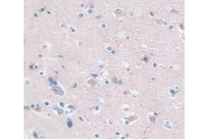 Figure. (Enkephalin antibody  (AA 25-267))