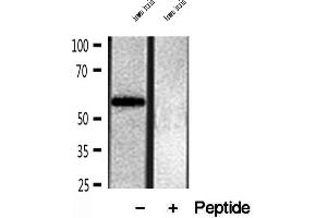 Western blot analysis of extracts of human brain tissue, using OXCT1 antibody. (OXCT1 antibody  (Internal Region))