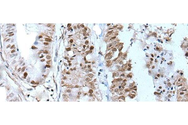 ZNHIT3 antibody