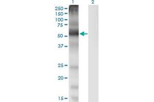 Western Blot analysis of SLC7A1 expression in transfected 293T cell line by SLC7A1 monoclonal antibody (M02), clone 2B9.