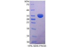 SDS-PAGE (SDS) image for Lipoprotein Lipase (LPL) (AA 55-316) protein (His tag) (ABIN2125695)