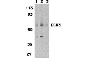 Western Blotting (WB) image for anti-Chemokine (C-C Motif) Receptor 3 (CCR3) (N-Term) antibody (ABIN1031307) (CCR3 antibody  (N-Term))