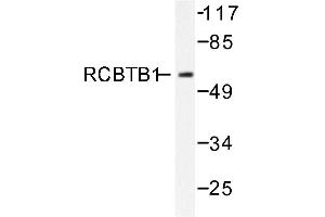 Image no. 1 for anti-Regulator of Chromosome Condensation (RCC1) and BTB (POZ) Domain Containing Protein 1 (RCBTB1) antibody (ABIN271804) (RCBTB1 antibody)