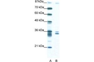 Western Blotting (WB) image for anti-PBX/knotted 1 Homeobox 2 (PKNOX2) antibody (ABIN2460704) (PKNOX2 antibody)