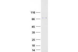 Validation with Western Blot
