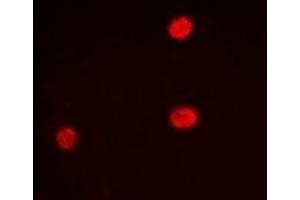 Immunofluorescent analysis of LRH-1 staining in Hela cells. (P2RX5 antibody)