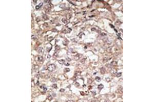 Image no. 2 for anti-Toll-Like Receptor 1 (TLR1) (C-Term) antibody (ABIN357041) (TLR1 antibody  (C-Term))