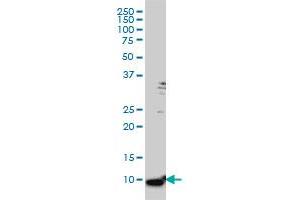 S100A6 monoclonal antibody (M16), clone 6D1 Western Blot analysis of S100A6 expression in HeLa .