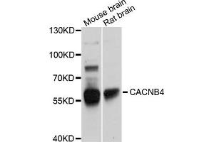 Western blot analysis of extracts of various cells, using CACNB4 antibody. (CACNB4 antibody)