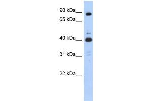 WB Suggested Anti-CDK9 Antibody Titration:  0.