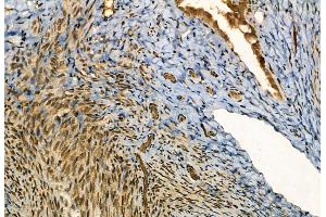 ABIN6257358 and ABIN6273564 at 1/100 staining Rat ovary tissue by IHC-P.