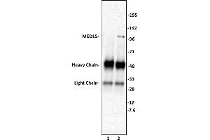 MED15 antibody (pAb) tested by Immunoprecipitation. (MED15 antibody  (C-Term))