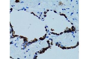 Immunohistochemistry of paraffin-embedded Human lung using CTSE Polyclonal Antibody at dilution of 1:100 (40x lens). (Cathepsin E antibody)