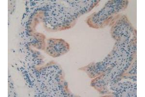 IHC-P analysis of Mouse Vas deferens Tissue, with DAB staining. (LCN8 antibody  (AA 27-176))