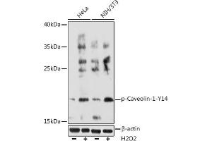 Western blot analysis of extracts of various cell lines, using Phospho-Caveolin-1-Y14 Rabbit pAb (ABIN6135195, ABIN6136032, ABIN6136033 and ABIN6225647) at 1:1000 dilution. (Caveolin-1 antibody  (pTyr14))