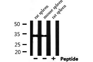 Western blot analysis of extracts from rat spleen, mouse spleen, using Phospho-Caspase 3 (Ser150) Antibody. (Caspase 3 antibody  (pSer150))