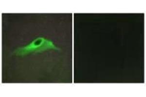 Immunofluorescence analysis of HeLa cells, using Collagen IV α5 antibody. (COL4a5 antibody)