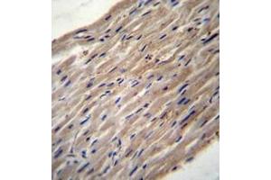 Immunohistochemistry analysis in formalin fixed and paraffin embedded human heart tissue reacted with PLOD1 / PLOD Antibody (N-term) followed which was peroxidase conjugated to the secondary antibody and followed by DAB staining. (PLOD1 antibody  (N-Term))
