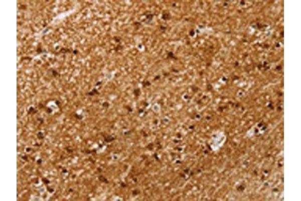 SSX4 antibody