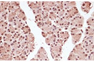 Immunohistochemistry of paraffin-embedded Rat pancreas using Phospho-ATF2(T71) Polyclonal Antibody at dilution of 1:100 (40x lens). (ATF2 antibody  (pThr71))