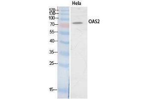Western Blotting (WB) image for anti-2'-5'-Oligoadenylate Synthetase 2, 69/71kDa (OAS2) (Internal Region) antibody (ABIN3178552) (OAS2 antibody  (Internal Region))