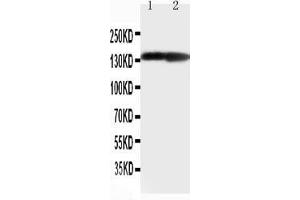 Anti-Collagen II antibody, Western blotting Lane 1: Rat Heart Tissue Lysate Lane 1: Rat Brain Tissue Lysate