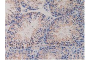 IHC-P analysis of Mouse Testis Tissue, with DAB staining. (PDGFRB antibody  (AA 337-583))