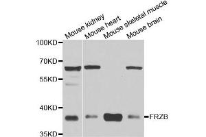 Western blot analysis of extracts of various cell lines, using FRZB antibody. (FRZB antibody)