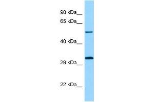 WB Suggested Anti-STK33 Antibody Titration: 1. (STK33 antibody  (N-Term))