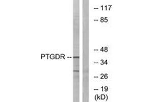 Western blot analysis of extracts from HepG2 cells, using PTGDR Antibody. (PTGDR antibody  (AA 263-312))