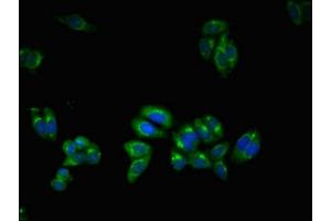 Immunofluorescent analysis of HepG2 cells using ABIN7174228 at dilution of 1:100 and Alexa Fluor 488-congugated AffiniPure Goat Anti-Rabbit IgG(H+L) (Ubiquilin 2 antibody  (AA 473-542))