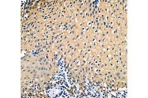 Immunohistochemistry of paraffin embedded human tonsil using IFIT5 (ABIN7074334) at dilution of 1:500 (300x lens) (IFIT5 antibody)