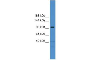 WB Suggested Anti-TRAK1  Antibody Titration: 0.