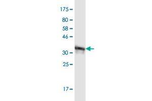 Western Blot detection against Immunogen (31. (MT-ND1 antibody  (AA 21-71))