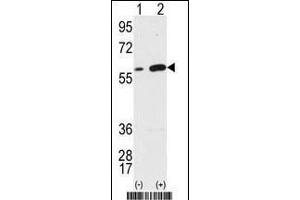 Western blot analysis of Vimentin (arrow) using Vimentin Antibody (Center) (ABIN389213 and ABIN2839368). (Vimentin antibody  (AA 152-181))
