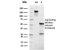 SDS-PAGE Analysis Purified C1QB Mouse Monoclonal Antibody (C1QB/2961).