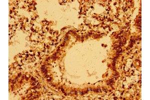 Immunohistochemistry of paraffin-embedded human lung tissue using ABIN7160437 at dilution of 1:100 (Chromosome 11open Reading Frame 9 (C11orf9) (AA 843-1004) antibody)