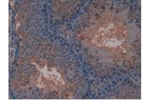 IHC-P analysis of Mouse Testis Tissue, with DAB staining. (FLT4 antibody  (AA 30-326))