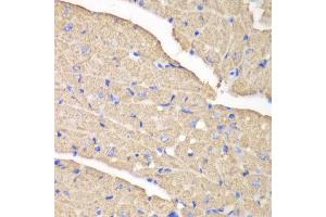 Immunohistochemistry (IHC) image for anti-Voltage-Dependent Anion Channel 1 (VDAC1) (AA 1-283) antibody (ABIN3021131) (VDAC1 antibody  (AA 1-283))