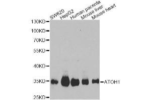 Western blot analysis of extracts of various cell lines, using ATOH1 Antibody. (ATOH1 antibody  (AA 215-354))