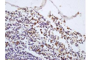 Formalin-fixed and paraffin embedded mouse spleen labeled with Rabbit Anti-IRAK1 (Thr387) Polyclonal Antibody, Unconjugated  at 1:200 followed by conjugation to the secondary antibody and DAB staining (IRAK1 antibody  (pThr387))