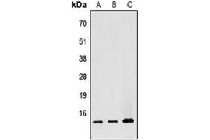 Western blot analysis of ATP5G1 expression in HEK293T (A), Raw264. (ATP5G1 antibody  (Center))