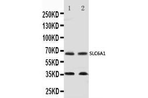 Anti-GABA Transporter 1/GAT 1 antibody, Western blotting Lane 1: Rat Brain Tissue Lysate Lane 2: Mouse Brain Tissue Lysate (SLC6A1 antibody  (C-Term))